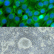ヒト近位尿細管上皮細胞の写真