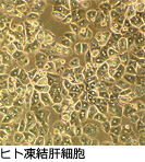 BPI凍結肝細胞の写真