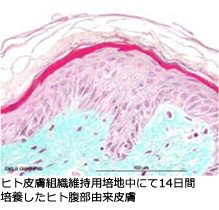 Human Skin Discs(ヒト新鮮皮膚)の写真