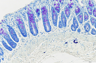 Pathological specimen preparation/pathological examination